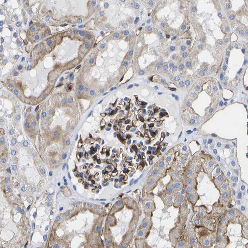 Dysferlin Antibody - BSA Free Immunohistochemistry-Paraffin: Dysferlin Antibody [NBP1-84696]
