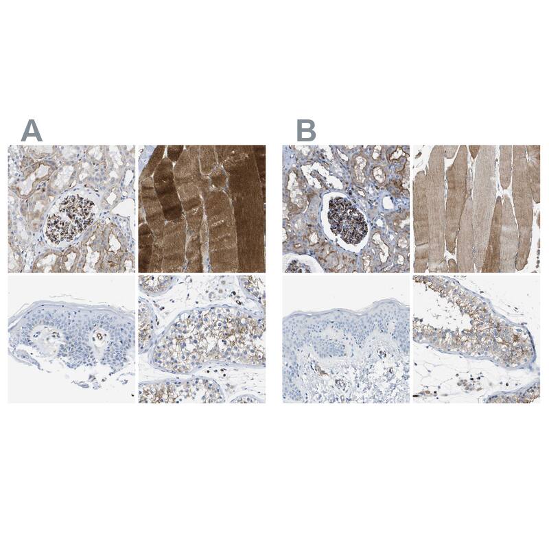 Dysferlin Antibody - BSA Free Immunohistochemistry-Paraffin: Dysferlin Antibody [NBP1-84696]
