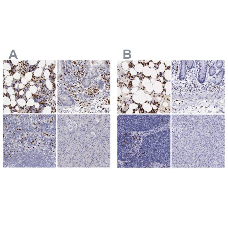 Ficolin-1 Antibody Immunohistochemistry-Paraffin: Ficolin-1 Antibody Antibody [NBP1-84705]