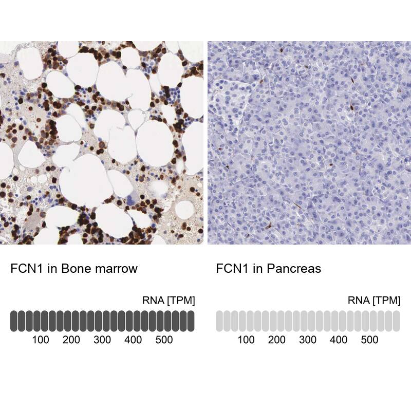 Ficolin-1 Antibody - BSA Free Immunohistochemistry-Paraffin: Ficolin-1 Antibody - BSA Free [NBP1-84706]