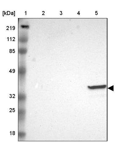 Ficolin-1 Antibody - BSA Free Western Blot: Ficolin-1 Antibody - BSA Free [NBP1-84706]