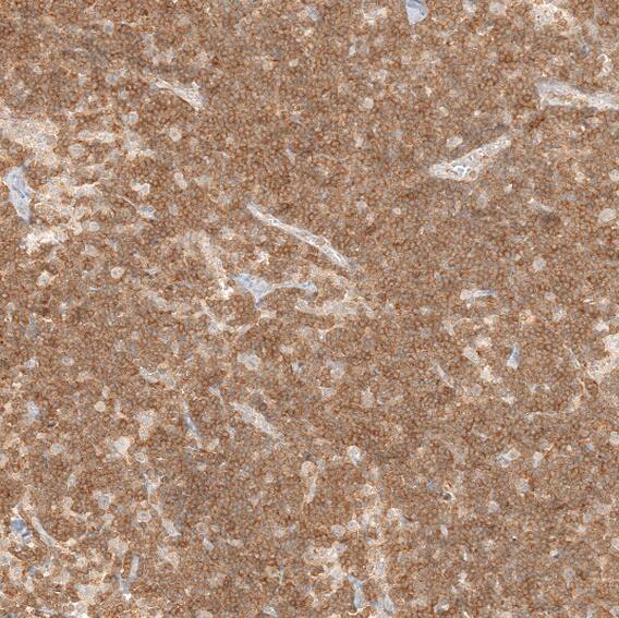 FBXO42 Antibody - BSA Free Immunohistochemistry-Paraffin: FBXO42 Antibody - BSA Free [NBP1-84711]