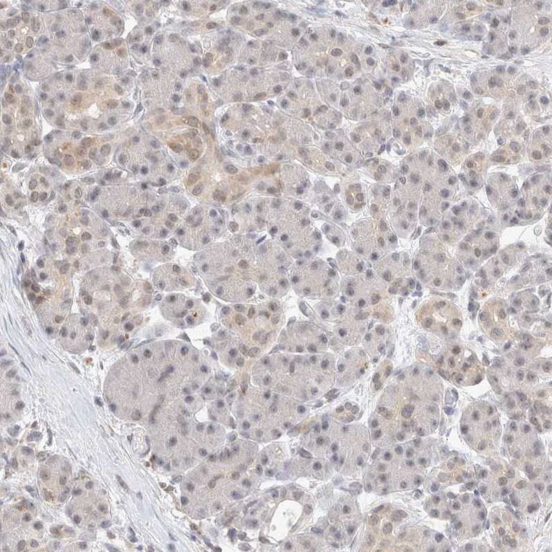 FBXO42 Antibody - BSA Free Immunohistochemistry-Paraffin: FBXO42 Antibody - BSA Free [NBP1-84711]