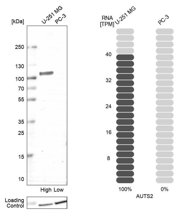 AUTS2 Antibody - BSA Free Western Blot: AUTS2 Antibody - BSA Free [NBP1-84717]