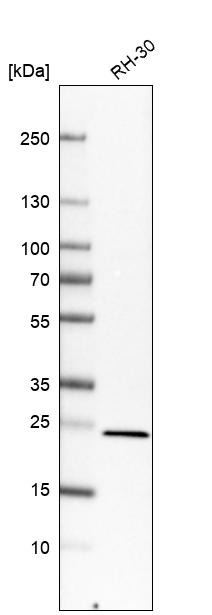 RAB14 Antibody - BSA Free Western Blot: RAB14 Antibody - BSA Free [NBP1-84720]