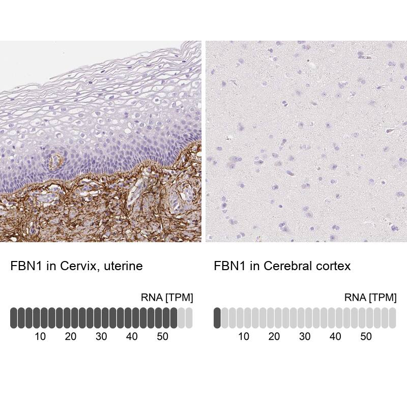 Fibrillin 1 Antibody - BSA Free Immunohistochemistry-Paraffin: Fibrillin 1 Antibody - BSA Free [NBP1-84722]