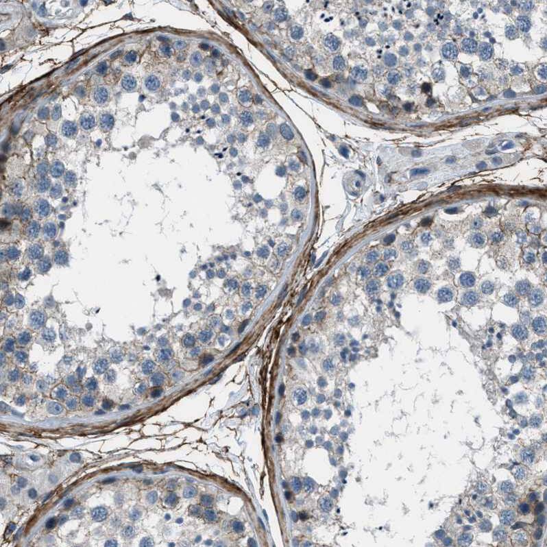 Fibrillin 1 Antibody - BSA Free Immunohistochemistry-Paraffin: Fibrillin 1 Antibody - BSA Free [NBP1-84723]