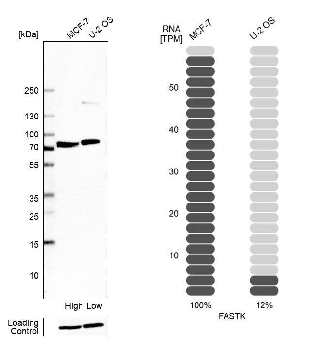 FASTK Antibody - BSA Free Western Blot: FASTK Antibody - BSA Free [NBP1-84729]