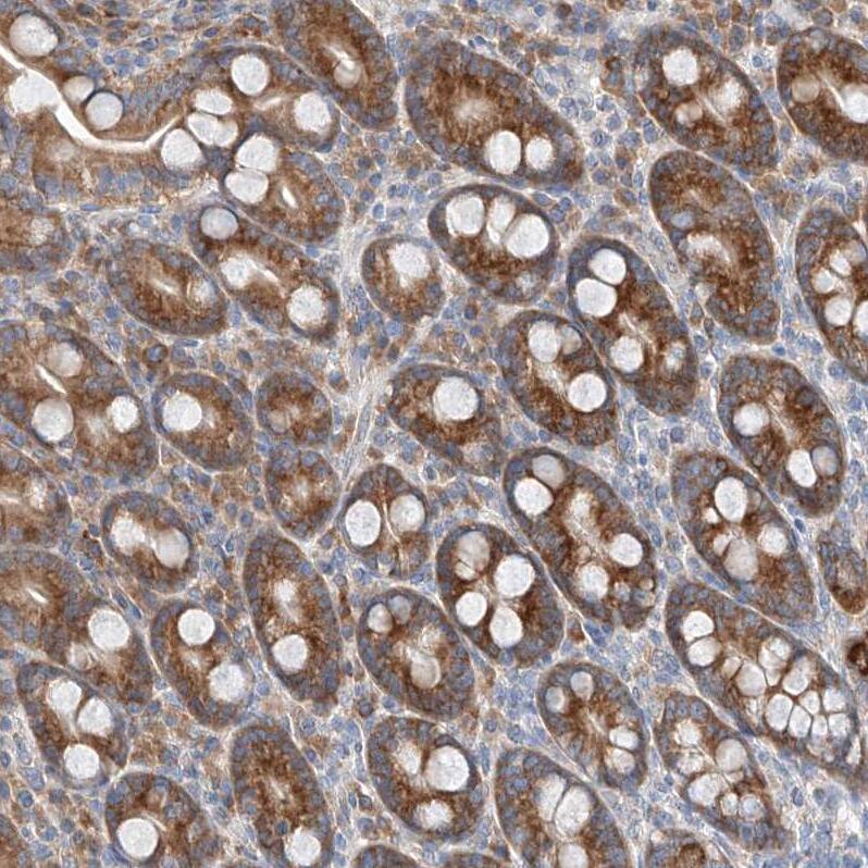 FASTK Antibody - BSA Free Immunohistochemistry-Paraffin: FASTK Antibody - BSA Free [NBP1-84729]
