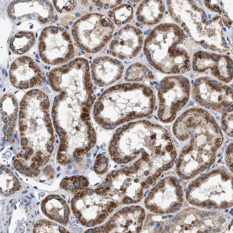 OXSM Antibody - BSA Free Immunohistochemistry-Paraffin: OXSM Antibody - BSA Free [NBP1-84730]