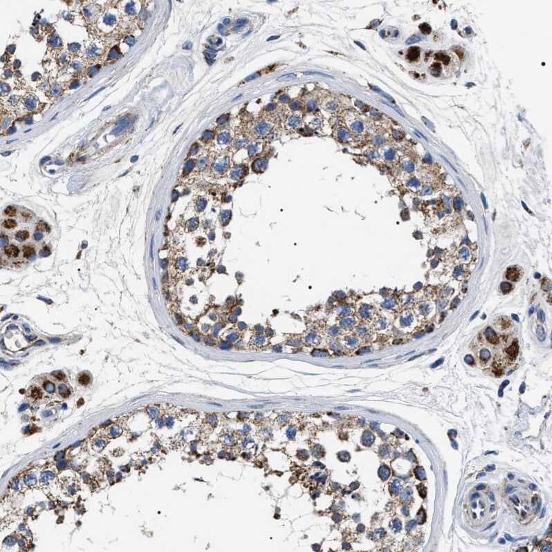 OXSM Antibody - BSA Free Immunohistochemistry-Paraffin: OXSM Antibody - BSA Free [NBP1-84730]