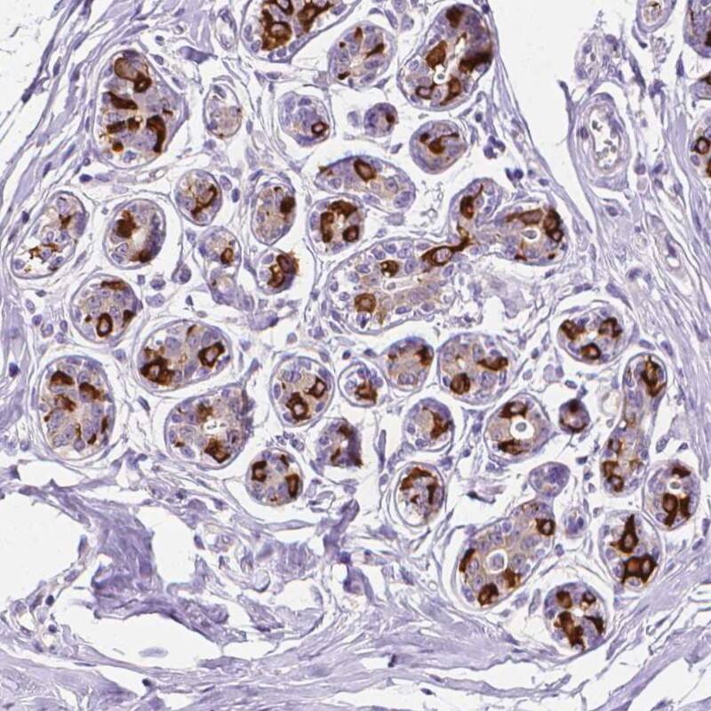 Fatty Acid Synthase/FASN Antibody - BSA Free Immunohistochemistry-Paraffin: Fatty Acid Synthase/FASN Antibody - BSA Free [NBP1-84733]