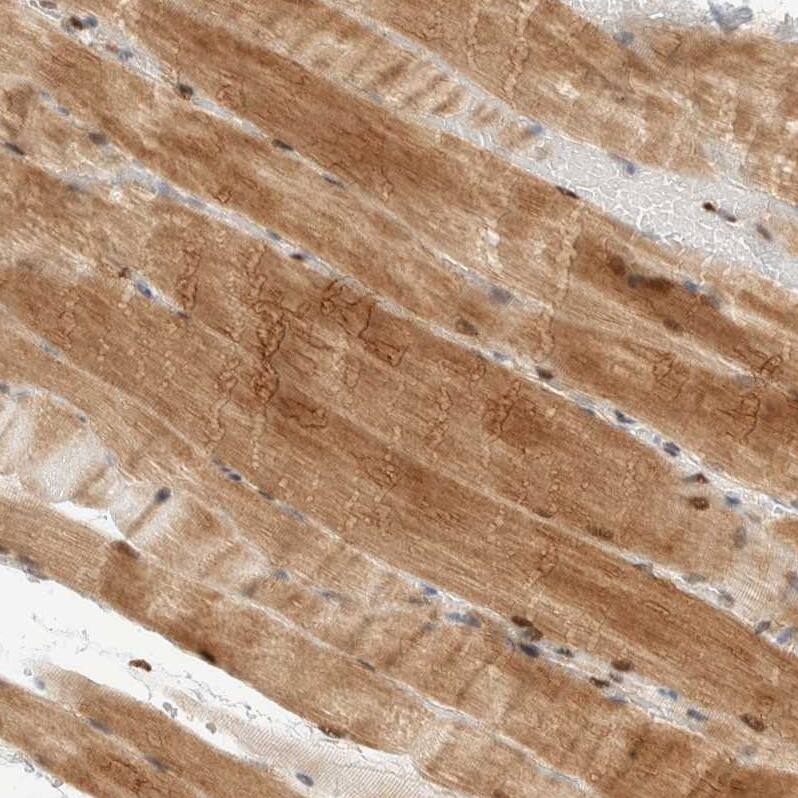 NSMAF Antibody - BSA Free Immunohistochemistry-Paraffin: NSMAF Antibody - BSA Free [NBP1-84735]