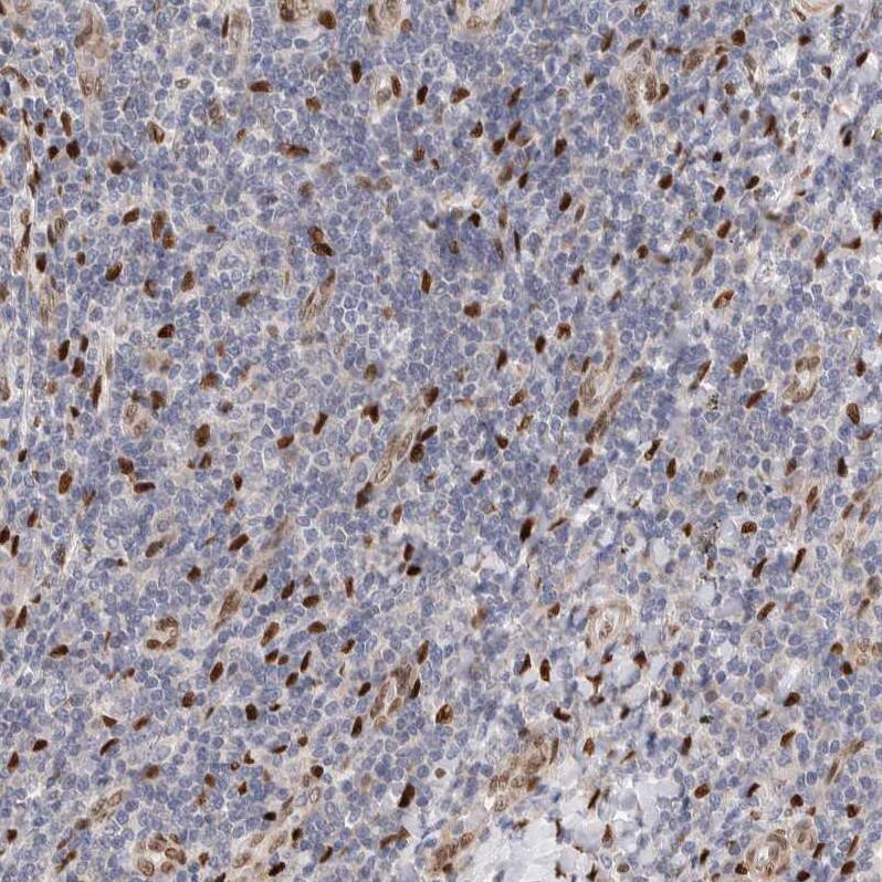 NSMAF Antibody - BSA Free Immunohistochemistry-Paraffin: NSMAF Antibody - BSA Free [NBP1-84735]