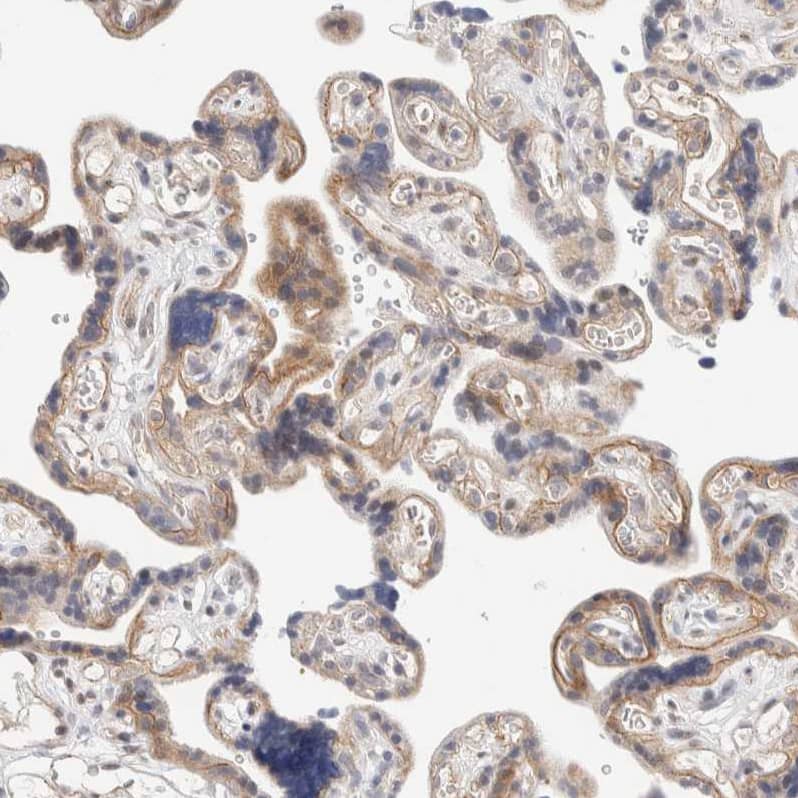 NSMAF Antibody - BSA Free Immunohistochemistry-Paraffin: NSMAF Antibody - BSA Free [NBP1-84735]