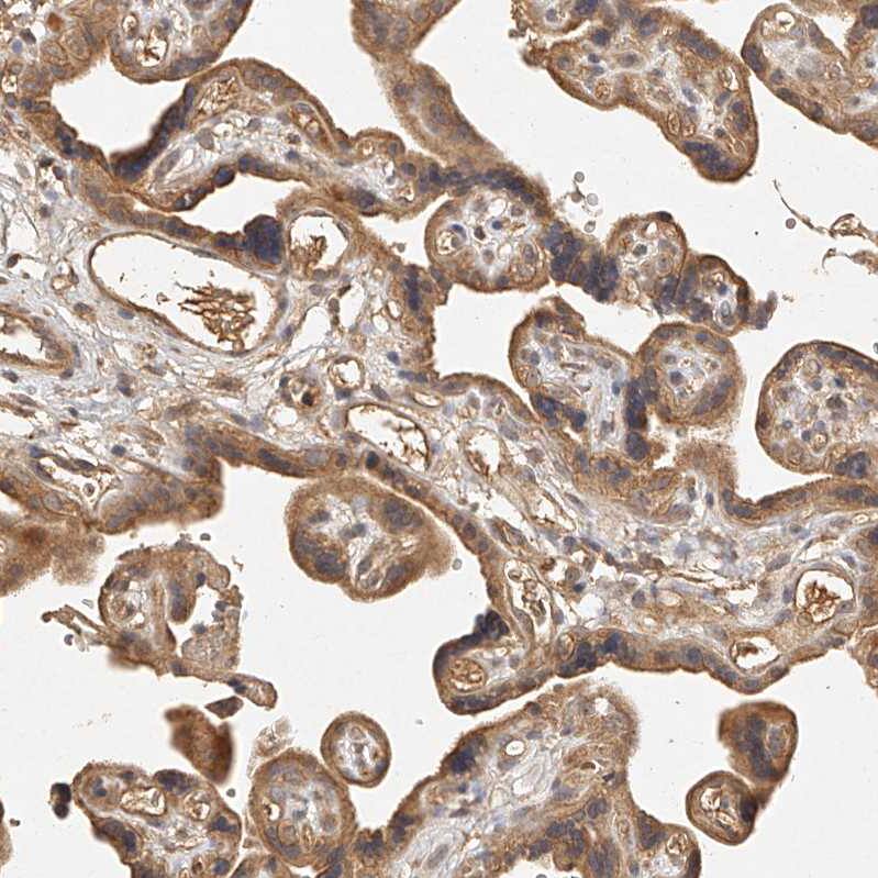 NSMAF Antibody - BSA Free Immunohistochemistry-Paraffin: NSMAF Antibody - BSA Free [NBP1-84736]