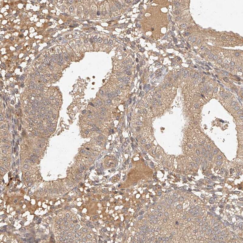 NSMAF Antibody - BSA Free Immunohistochemistry-Paraffin: NSMAF Antibody - BSA Free [NBP1-84736]