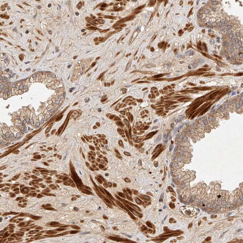 NSMAF Antibody - BSA Free Immunohistochemistry-Paraffin: NSMAF Antibody - BSA Free [NBP1-84736]