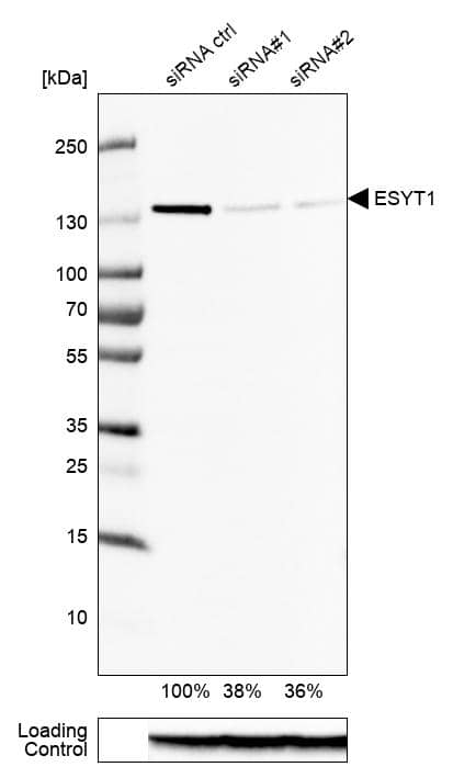 FAM62A Antibody - BSA Free Western Blot: FAM62A Antibody - BSA Free [NBP1-84741]