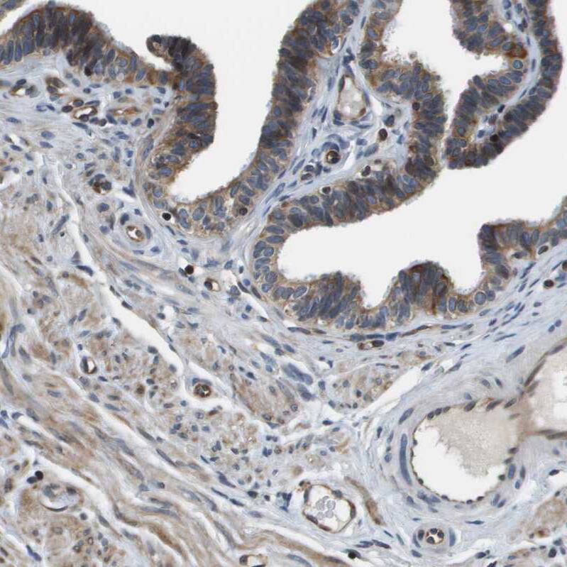 FAM62A Antibody - BSA Free Immunohistochemistry-Paraffin: FAM62A Antibody - BSA Free [NBP1-84741]