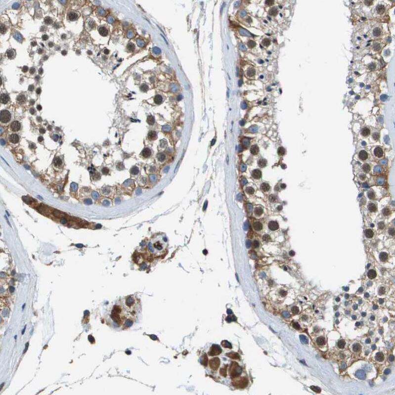 FAM62A Antibody - BSA Free Immunohistochemistry-Paraffin: FAM62A Antibody - BSA Free [NBP1-84741]