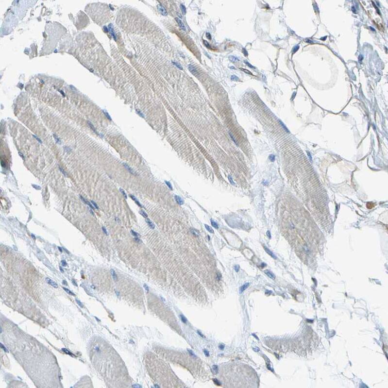 FAM62A Antibody - BSA Free Immunohistochemistry-Paraffin: FAM62A Antibody - BSA Free [NBP1-84741]
