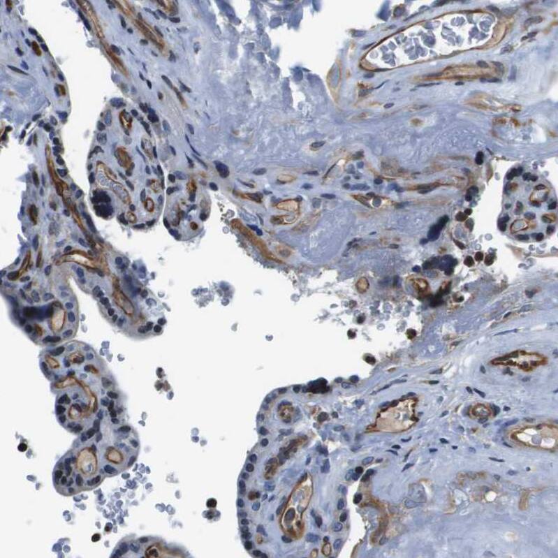 FAM62A Antibody - BSA Free Immunohistochemistry-Paraffin: FAM62A Antibody - BSA Free [NBP1-84741]