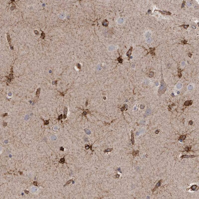 FLAD1 Antibody - BSA Free Immunohistochemistry-Paraffin: FLAD1 Antibody - BSA Free [NBP1-84752]