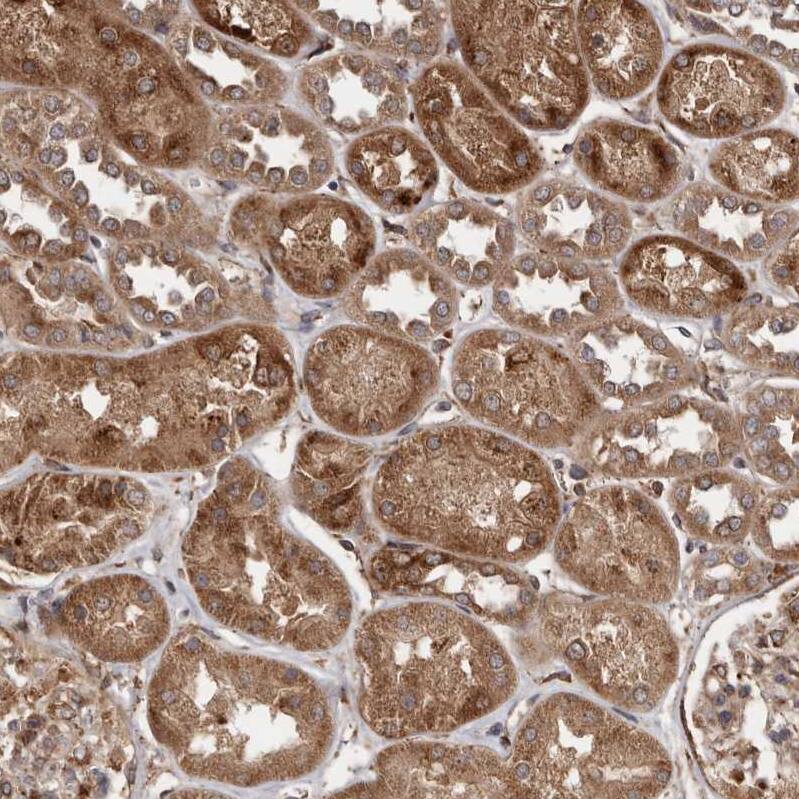 FLAD1 Antibody - BSA Free Immunohistochemistry-Paraffin: FLAD1 Antibody - BSA Free [NBP1-84752]