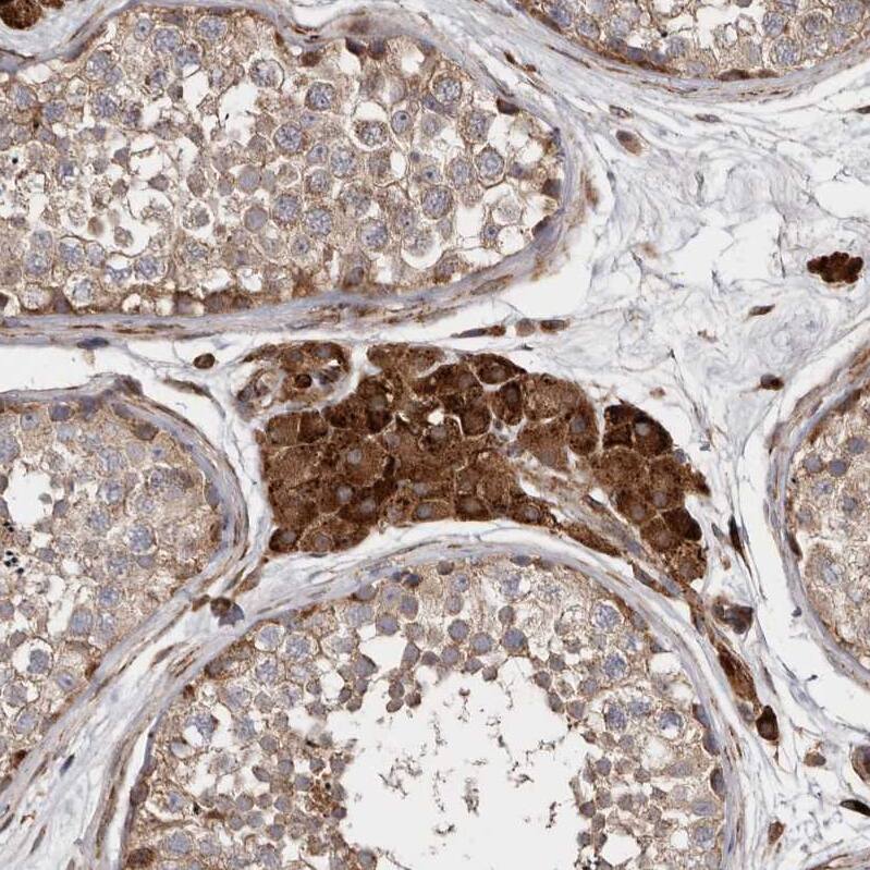 FLAD1 Antibody - BSA Free Immunohistochemistry-Paraffin: FLAD1 Antibody - BSA Free [NBP1-84752]