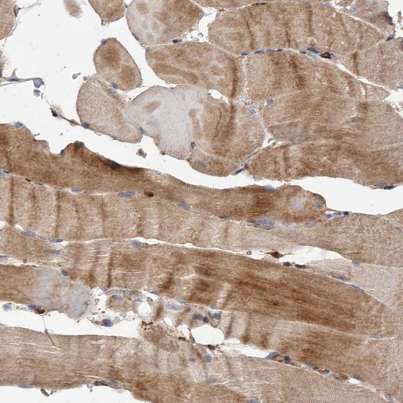 FLAD1 Antibody - BSA Free Immunohistochemistry-Paraffin: FLAD1 Antibody - BSA Free [NBP1-84752]