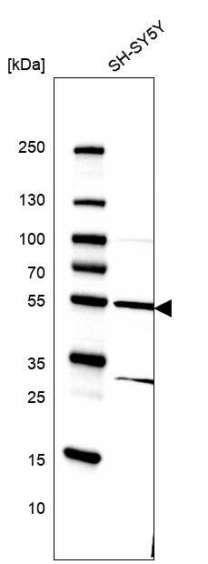 FLAD1 Antibody - BSA Free Western Blot: FLAD1 Antibody - BSA Free [NBP1-84752]