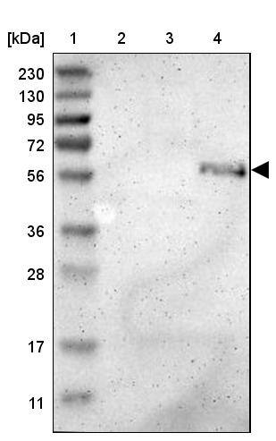 ZMPSTE24 Antibody - BSA Free Western Blot: ZMPSTE24 Antibody - BSA Free [NBP1-84755]
