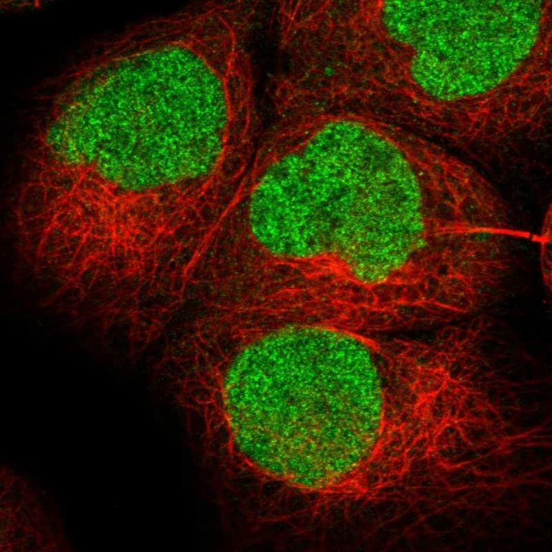 BPTF/FALZ Antibody - BSA Free Immunocytochemistry/ Immunofluorescence: BPTF/FALZ Antibody [NBP1-84756]