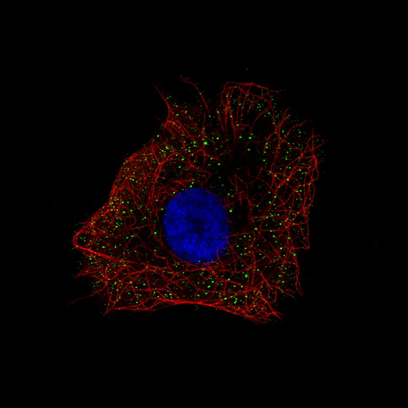 Norrin/NDP Antibody Immunocytochemistry/Immunofluorescence: Norrin/NDP Antibody [NBP1-84769]