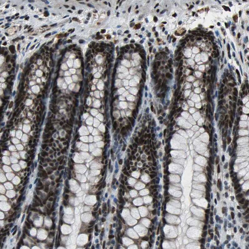 ELF2 Antibody - BSA Free Immunohistochemistry-Paraffin: ELF2 Antibody - BSA Free [NBP1-84770]