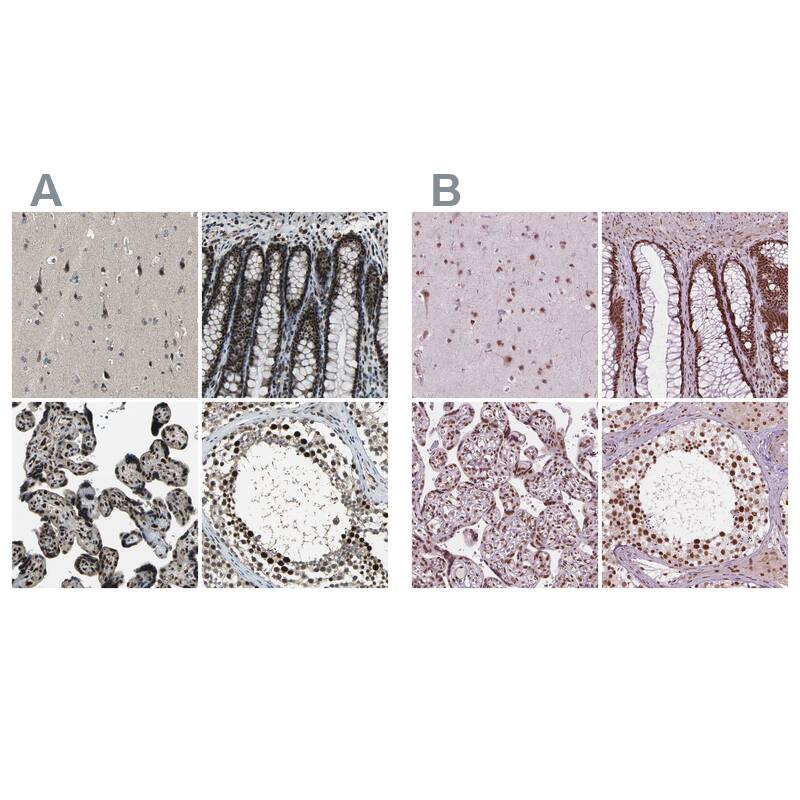 ELF2 Antibody - BSA Free Immunohistochemistry-Paraffin: ELF2 Antibody - BSA Free [NBP1-84770]