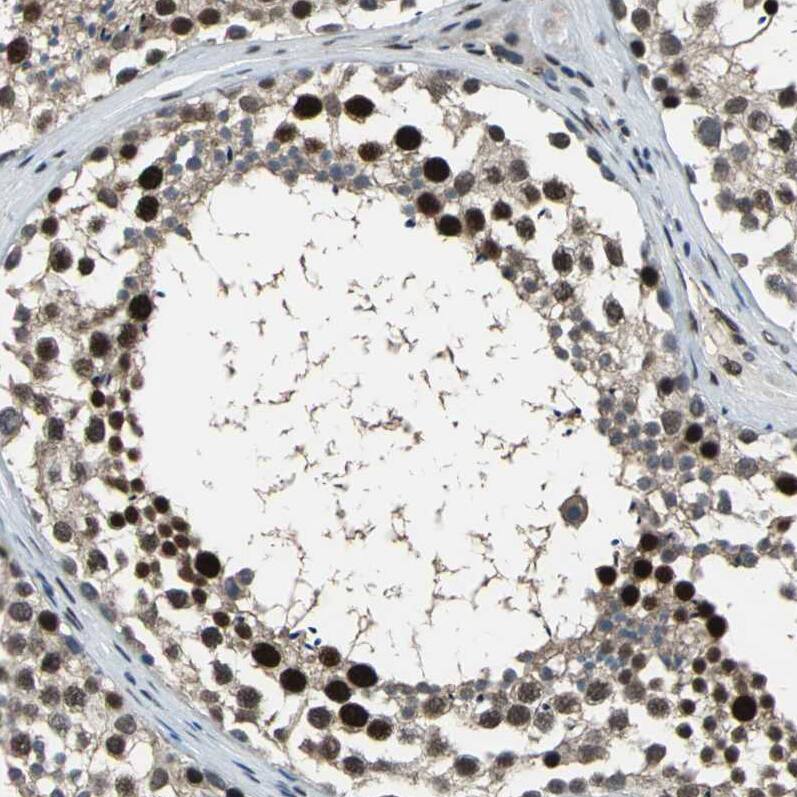 ELF2 Antibody - BSA Free Immunohistochemistry-Paraffin: ELF2 Antibody - BSA Free [NBP1-84770]