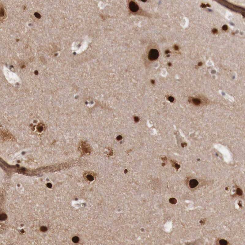 KHDRBS3 Antibody - BSA Free Immunohistochemistry-Paraffin: KHDRBS3 Antibody [NBP1-84774]