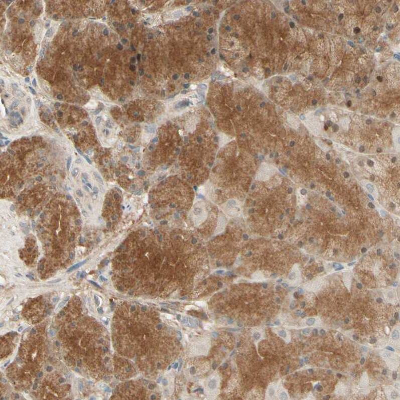 EphB3 Antibody - BSA Free Immunohistochemistry-Paraffin: EphB3 Antibody - BSA Free [NBP1-84776]