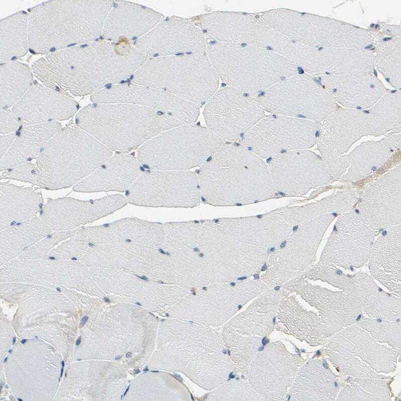 EphB3 Antibody - BSA Free Immunohistochemistry-Paraffin: EphB3 Antibody - BSA Free [NBP1-84776]