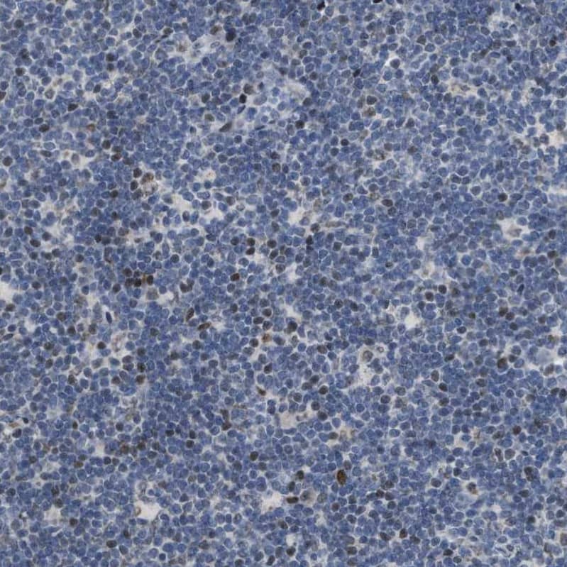 SETDB1 Antibody - BSA Free Immunohistochemistry-Paraffin: SETDB1 Antibody - BSA Free [NBP1-84790]