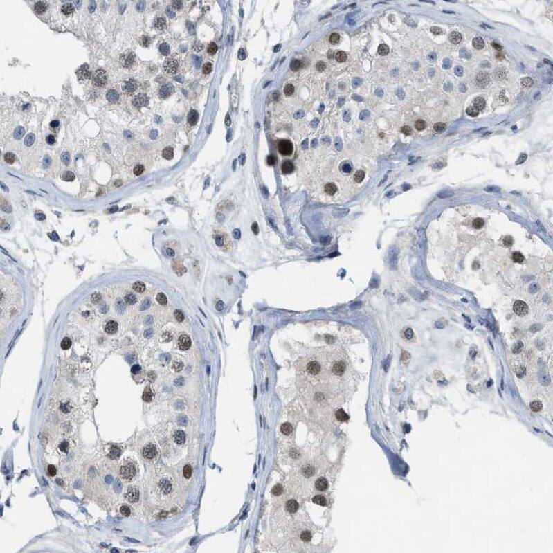 SETDB1 Antibody - BSA Free Immunohistochemistry-Paraffin: SETDB1 Antibody - BSA Free [NBP1-84790]