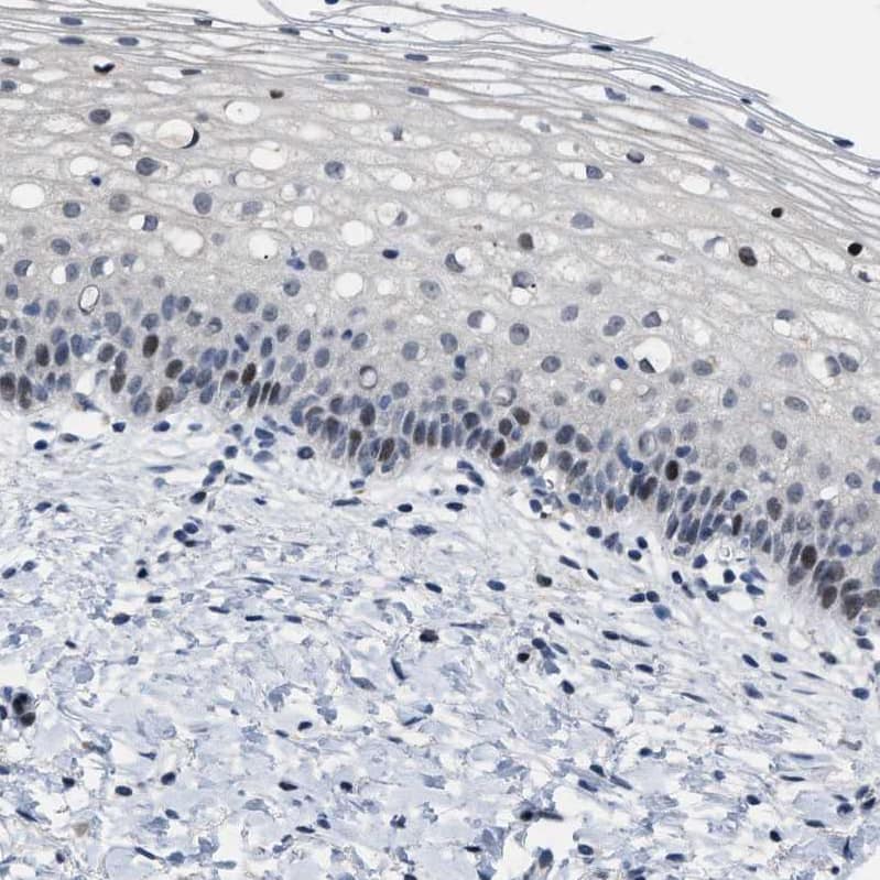 SETDB1 Antibody - BSA Free Immunohistochemistry-Paraffin: SETDB1 Antibody - BSA Free [NBP1-84790]