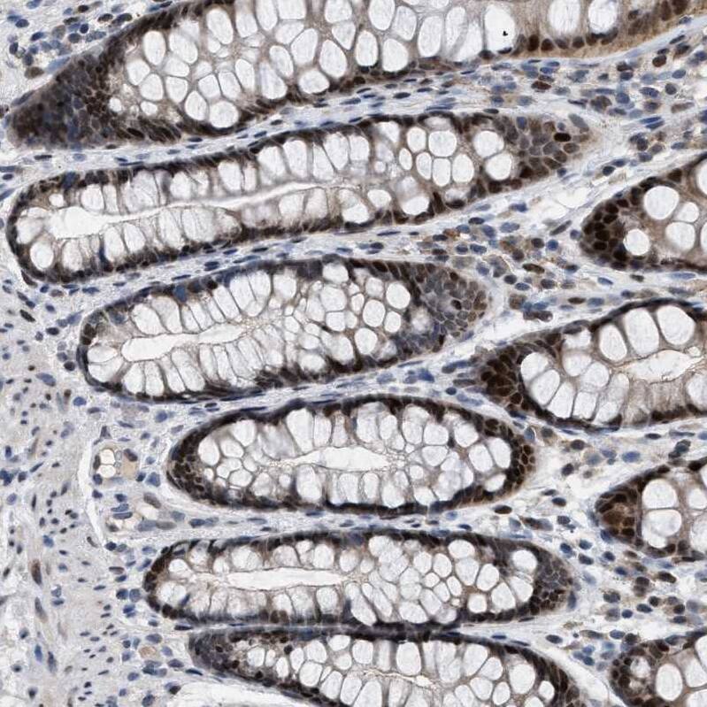SETDB1 Antibody - BSA Free Immunohistochemistry-Paraffin: SETDB1 Antibody - BSA Free [NBP1-84790]