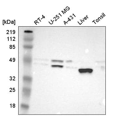 PON1 Antibody - BSA Free Western Blot: PON1 Antibody - BSA Free [NBP1-84791]