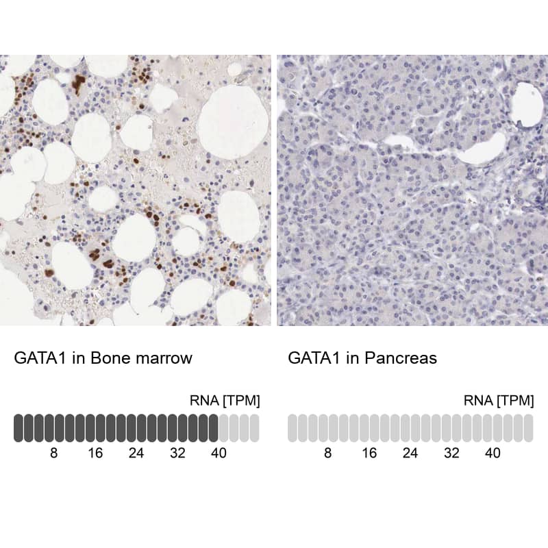GATA-1 Antibody - BSA Free Immunohistochemistry-Paraffin: GATA-1 Antibody - BSA Free [NBP1-84793]