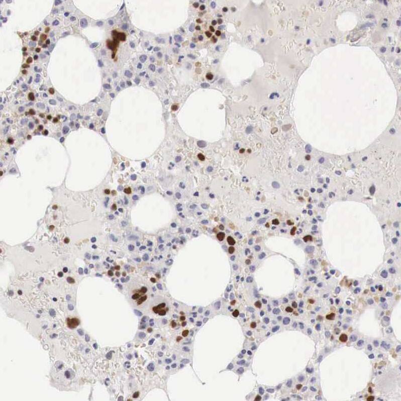 GATA-1 Antibody - BSA Free Immunohistochemistry-Paraffin: GATA-1 Antibody - BSA Free [NBP1-84793]
