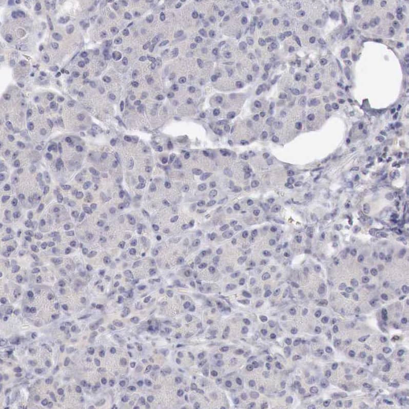 GATA-1 Antibody - BSA Free Immunohistochemistry-Paraffin: GATA-1 Antibody - BSA Free [NBP1-84793]