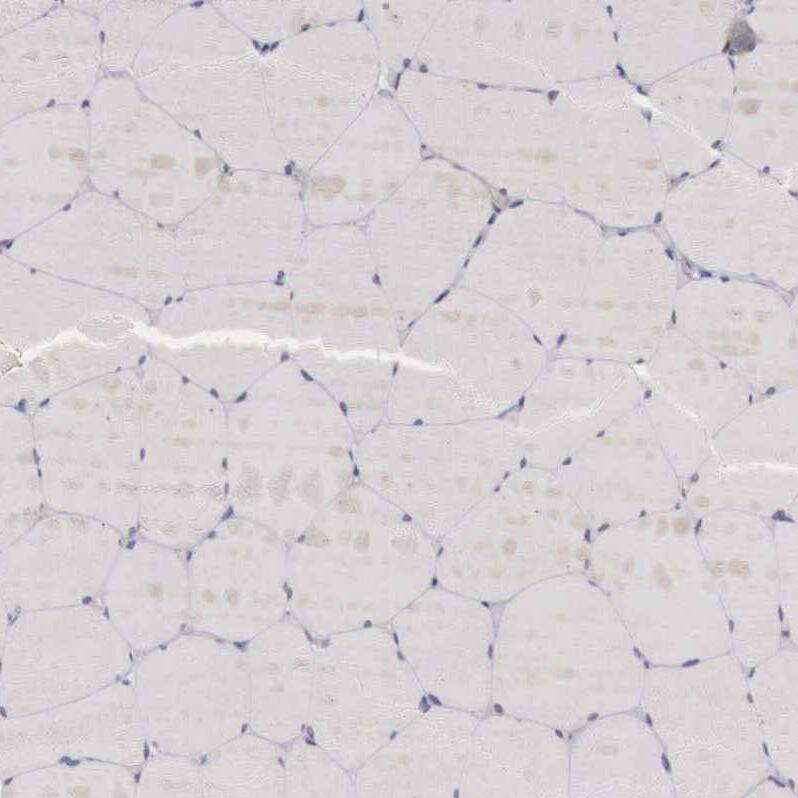 GATA-1 Antibody - BSA Free Immunohistochemistry-Paraffin: GATA-1 Antibody - BSA Free [NBP1-84793]